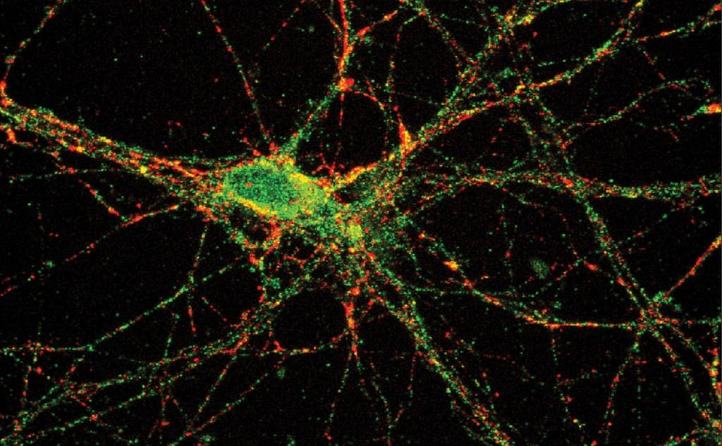 🧠 Além da Limite: A Incrível Máquina de Memórias do Seu Cérebro