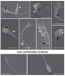🧬 O Parasita que Decapita Espermatozoides: Uma Ameaça Silenciosa à Fertilidade Masculina