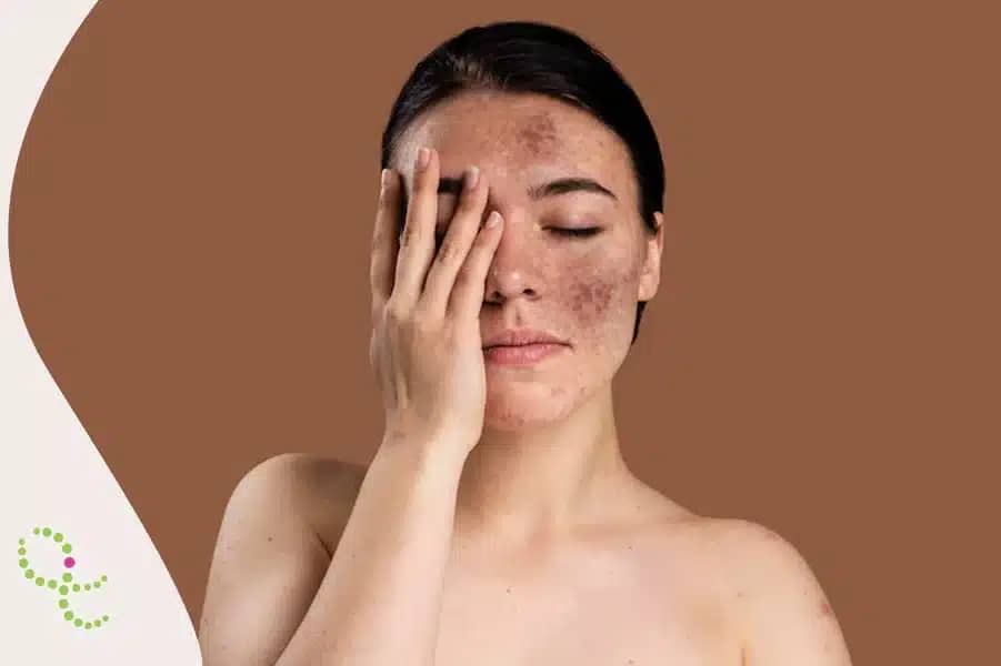 Você sabia que sua urina pode ficar preta?